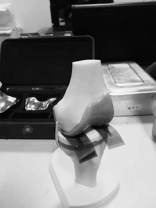 黃維團(tuán)隊(duì)與西安紅會(huì)醫(yī)院開(kāi)展合作，推動(dòng)柔性電子在輔助膝關(guān)節(jié)置換手術(shù)中的應(yīng)用